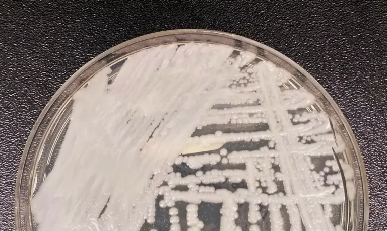 2019-04-09t220810z_1383098163_rc13eb8625f0_rtrmadp_3_usa-health-superbug