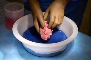transplante-rim-porco-20102021091357042